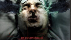 Thérapie ou Torture – La vérité sur les électrochocs