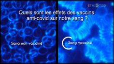 quels-sont-les-effets-des-vaccins-anti-covid-sur-notre-sang-DissidenceTV