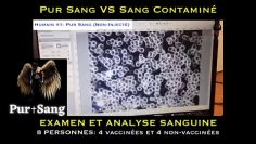 examen-sanguin-au-microscope-vaccines-vs-non-vaccines-DissidenceTV