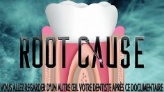 root-cause-vostfr—dents-devitalisees-DissidenceTV